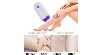 Sensor Light Hair Remover - Face, Legs, Arms and More!