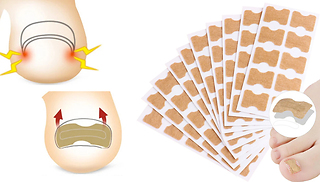 20 or 40-Pack Ingrown Nail Correcting Stickers